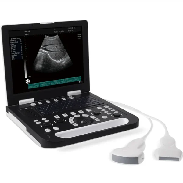 Sonoscape Portable Laptop 2D 3D 4D Color Doppler Ultrasound Scanner Machine for Veterinary and Human