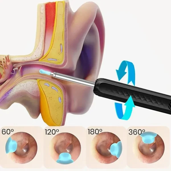 Wireless WiFi Ear Pick Otoscope Camera Borescope Luminous Ear Wax Cleaning Teeth Oral Inspection Health Care Ear Cleaner Kit - Image 6