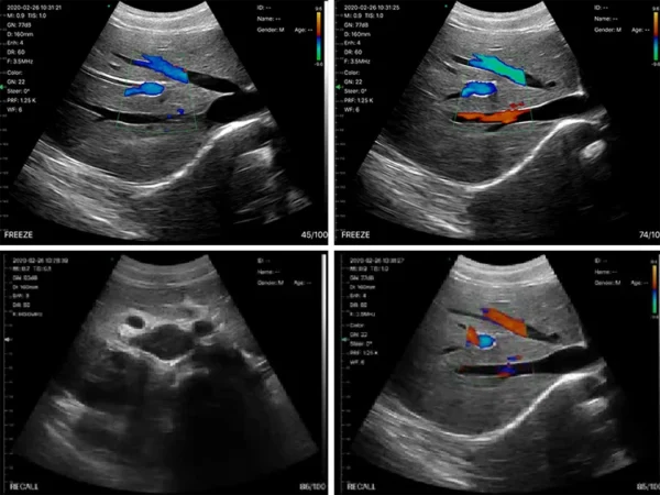 Portable Handheld Ultrasound Scanner Machine For Human With Wireless Probe - Image 4